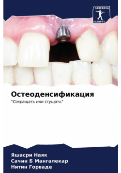 Остеоденсификация