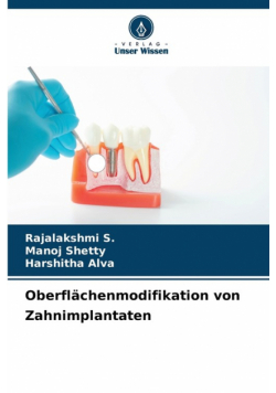 Oberflächenmodifikation von Zahnimplantaten
