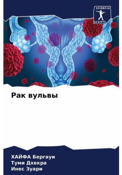 Рак вульвы
