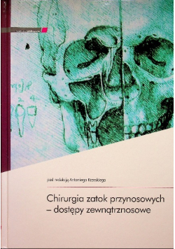 Chirurgia zatok przynosowych - dostępy zewnątrznosowe