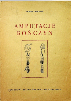 Amputacje kończyn