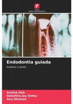 Endodontia guiada
