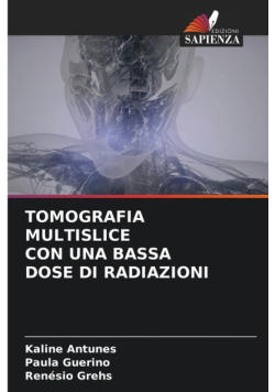 Tomografia Multislice Con Una Bassa Dose Di Radiazioni