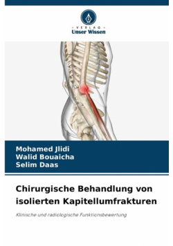 Chirurgische Behandlung von isolierten Kapitellumfrakturen