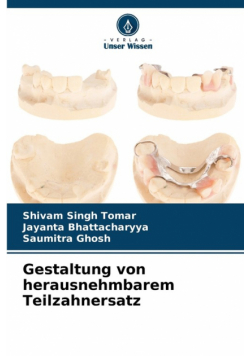 Gestaltung von herausnehmbarem Teilzahnersatz