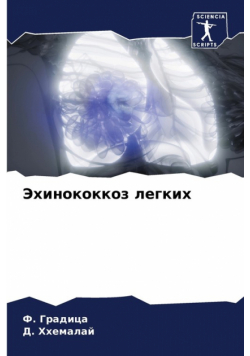 Эхинококкоз легких