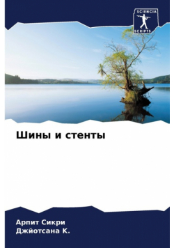 Шины и стенты