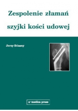 Zespolenie złamań szyjki kości udowej