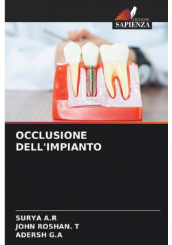 Occlusione Dell'impianto