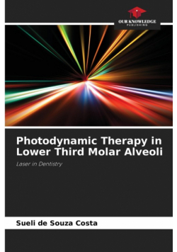 Photodynamic Therapy in Lower Third Molar Alveoli