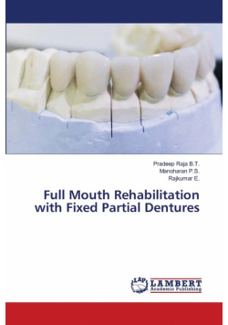 Full Mouth Rehabilitation with Fixed Partial Dentures
