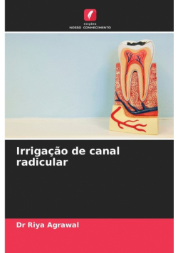 Irrigação de canal radicular