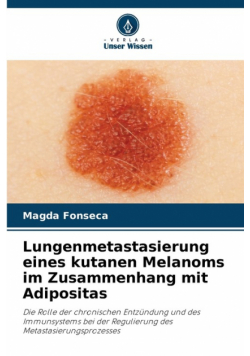 Lungenmetastasierung eines kutanen Melanoms im Zusammenhang mit Adipositas