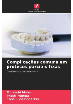 Complicações comuns em próteses parciais fixas