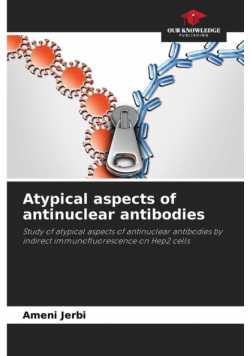 Atypical aspects of antinuclear antibodies