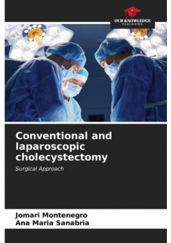 Conventional and laparoscopic cholecystectomy