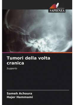 Tumori della volta cranica