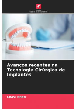 Avanços recentes na Tecnologia Cirúrgica de Implantes