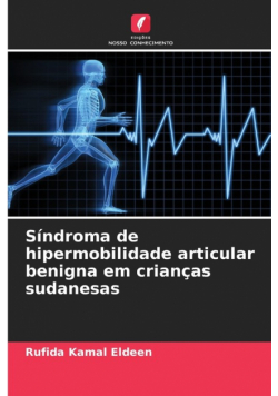 Síndroma de hipermobilidade articular benigna em crianças sudanesas