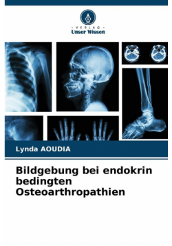 Bildgebung bei endokrin bedingten Osteoarthropathien