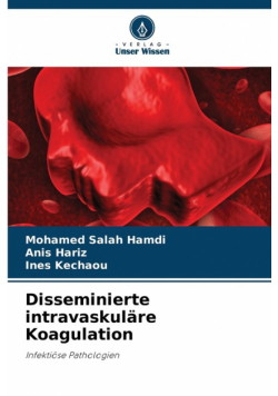 Disseminierte intravaskuläre Koagulation