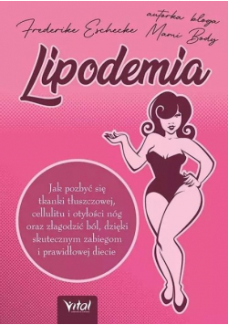 Lipodemia