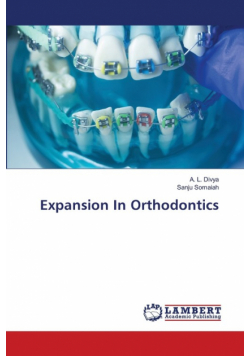 Expansion In Orthodontics