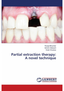 Partial extraction therapy