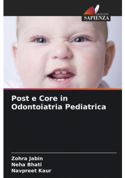 Post e Core in Odontoiatria Pediatrica