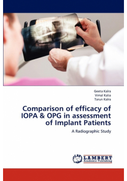Comparison of efficacy of IOPA & OPG in assessment of Implant Patients