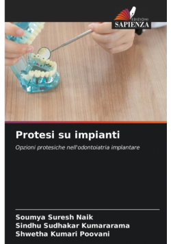 Protesi su impianti