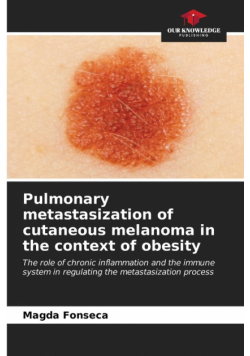 Pulmonary metastasization of cutaneous melanoma in the context of obesity