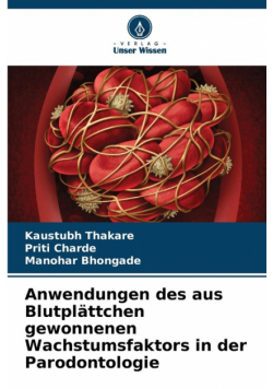 Anwendungen des aus Blutplättchen gewonnenen Wachstumsfaktors in der Parodontologie