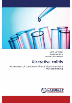 Ulcerative colitis