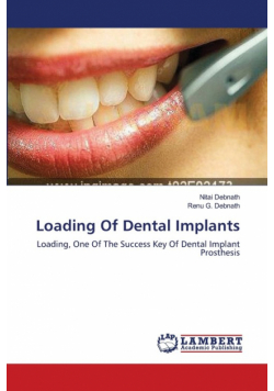 Loading Of Dental Implants