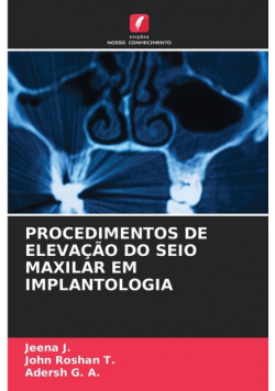 Procedimentos De Elevação Do Seio Maxilar Em Implantologia