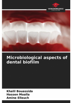Microbiological aspects of dental biofilm