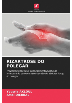 Rizartrose Do Polegar