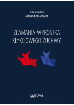 Złamania wyrostka kłykciowego żuchwy