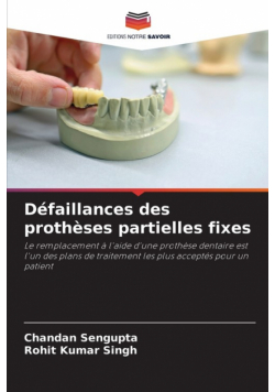Défaillances des prothèses partielles fixes