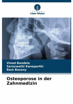 Osteoporose in der Zahnmedizin