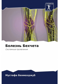 Болезнь Бехчета