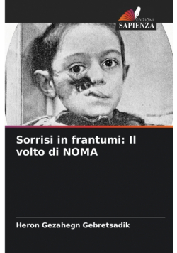 Sorrisi in frantumi