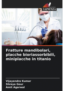 Fratture mandibolari, placche bioriassorbibili, miniplacche in titanio
