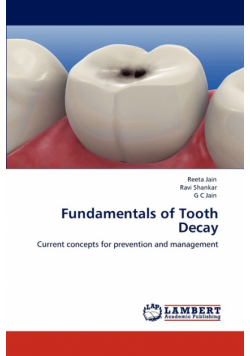 Fundamentals of Tooth Decay