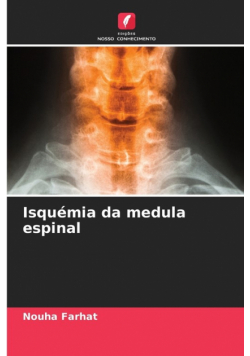 Isquémia da medula espinal