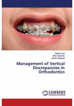 Management of Vertical Discrepancies in Orthodontics