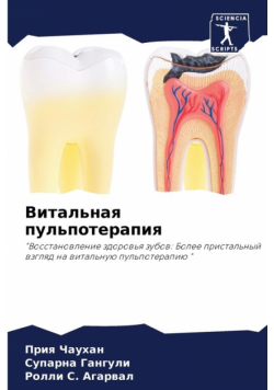 Витальная пульпотерапия