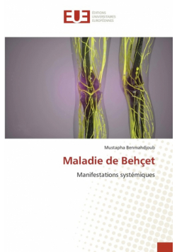 Maladie de Behçet