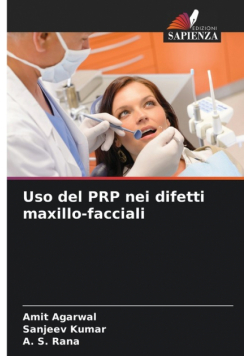 Uso del PRP nei difetti maxillo-facciali